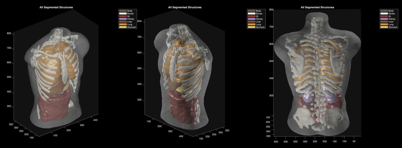 Midjourney revela scanner médico de corpo inteiro e anuncia spa de saúde em San Francisco