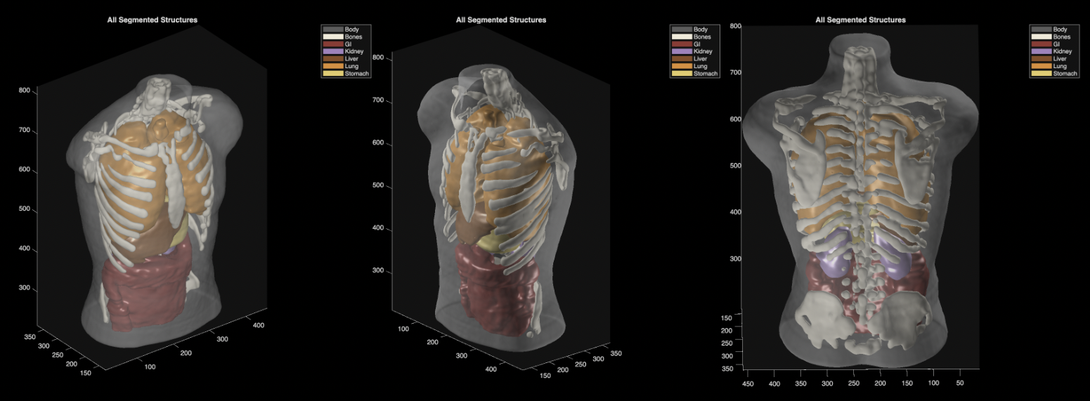 Midjourney revela scanner médico de corpo inteiro e anuncia spa de saúde em San Francisco